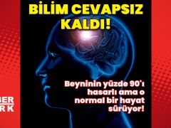 Beyninin yüzde 90’ı zararlı ama o sıradan bir hayat sürüyor! Bilim yanıtsız kaldı