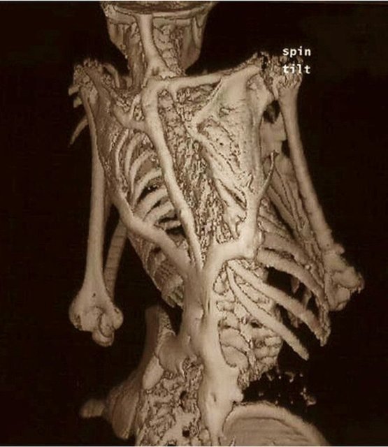 Dünyada en nadir görülen 9 hastalık! Daha önce kesin duymadınız!
