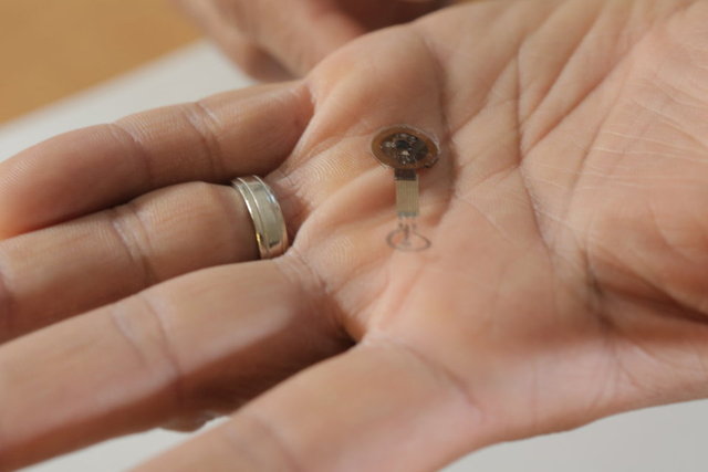 Türünün ilk örneği olan elektronik yara bandı iyileşmeyi hızlandırıyor