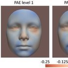 HAMİLELİKTE ALKOL TÜKETİMİNE KARŞI YENİ BİR ARAŞTIRMA